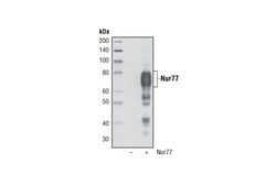 Cell Signaling Technology&nbsp;Nur77 D63C5 XPR Rabbit mAb