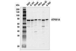 Cell Signaling Technology&nbsp;ATP6V1A E5N9E Rabbit mAb 100