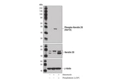 Cell Signaling Technology&nbsp;Phospho-Keratin 20 Ser13 D9