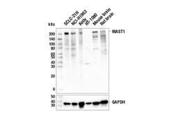 Cell Signaling Technology&nbsp;MAST1 E4K5G Rabbit mAb 100 u