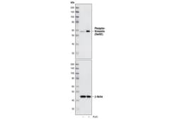 Cell Signaling Technology&nbsp;Phospho-Vimentin Ser83 Antib