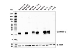 Cell Signaling Technology&nbsp;Stathmin-2 E1D2M Rabbit mAb