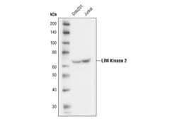 Cell Signaling Technology&nbsp;LIMK2 8C11 Rabbit mAb 20 ul
