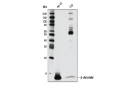 Cell Signaling Technology&nbsp;beta-Amyloid D54D2 XPR Rab