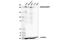 Cell Signaling Technology&nbsp;ARID4A/RbBP1 E2T6V Rabbit mA