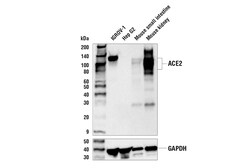 Cell Signaling Technology&nbsp;ACE2 E9G3S Mouse mAb 100 ul