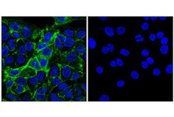 Cell Signaling Technology PLVAP E3X9D Rabbit mAb 100 u, Quantity: Each