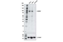 Cell Signaling Technology&nbsp;SATB2 E4N4A Rabbit mAb 100 u