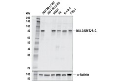 Cell Signaling Technology&nbsp;MLL2/KMT2B E6A8V Rabbit mAb