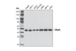 Cell Signaling Technology&nbsp;ERp44 D17A6 XPR Rabbit mAb