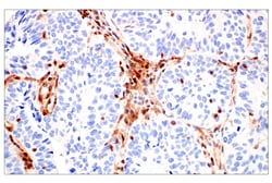 Cell Signaling Technology&nbsp;SERPINB9 E9J8J XPR Rabbit