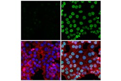 Cell Signaling Technology Ubiquityl-Histone H3 Lys18
