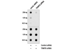 Cell Signaling Technology&nbsp;N1-Methyladenosine m1A E8S7