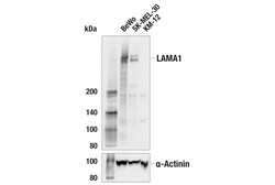 Cell Signaling Technology&nbsp;LAMA1 E4M5B Rabbit mAb 100 u