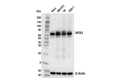 Cell Signaling Technology MTA3 E3X2E Rabbit mAb 100 ul