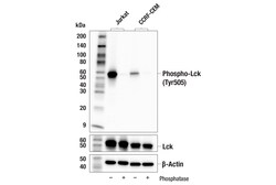 Cell Signaling Technology&nbsp;Phospho-Lck Tyr505 E3Z5E R
