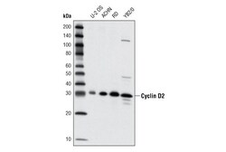 Cell Signaling Technology&nbsp;Cyclin D2 D52F9 Rabbit mAb 2
