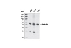 Cell Signaling Technology TNF-R1 C25C1 Rabbit mAb 20 u