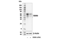 Cell Signaling Technology&nbsp;RBM9 E7W6U Rabbit mAb 100 ul