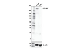 Cell Signaling Technology&nbsp;COL5A1 Antibody 100 ul