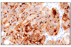 Cell Signaling Technology Folate Receptor Alpha/FOLR1 B