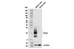 Cell Signaling Technology&nbsp;Reg4 E7Z7S Rabbit mAb 100 ul
