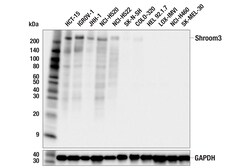 Cell Signaling Technology&nbsp;Shroom3 F8O8B Rabbit mAb 100