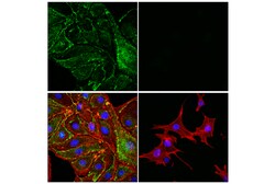Cell Signaling Technology PLVAP E9W8D Rabbit mAb 100 u