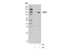 Cell Signaling Technology&nbsp;IRP2 D6E6W Rabbit mAb 100 ul