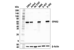 Cell Signaling Technology EPHX2 F9Z3M Rabbit mAb 100 u