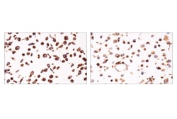 Cell Signaling Technology&nbsp;SHMT2 E8O8J Rabbit mAb 100 u