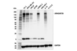 Cell Signaling Technology&nbsp;ARHGAP29 F6O5B Rabbit mAb 10