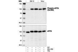 Cell Signaling Technology&nbsp;Phospho-eEF2k Ser366 Antibod