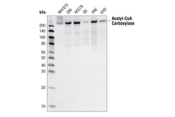 Cell Signaling Technology&nbsp;Acetyl-CoA Carboxylase C83B10