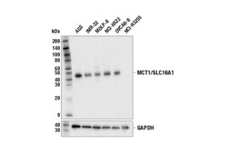Cell Signaling Technology&nbsp;MCT1/SLC16A1 E7F6Y Rabbit mA