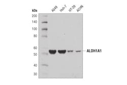 Cell Signaling Technology&nbsp;ALDH1A1 D9J7R XP R  Rabbit