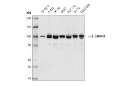 Cell Signaling Technology alpha-E-Catenin D9R5E Rabbit