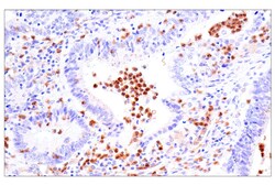 Cell Signaling Technology&nbsp;LRRK2 E8Z7T Mouse mAb 100 ul