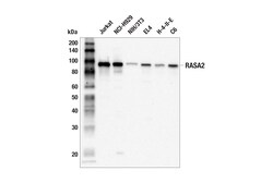 Cell Signaling Technology&nbsp;RASA2 F2O1I Rabbit mAb 100 u