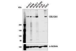 Cell Signaling Technology&nbsp;COL12A1 F4D4U Rabbit mAb 100