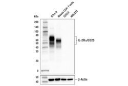 Cell Signaling Technology&nbsp;IL-2R-alpha/CD25 E4B2Z XPR
