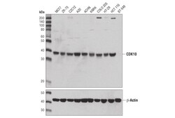 Cell Signaling Technology&nbsp;CDK10 D8Z7Z Rabbit mAb 100 u