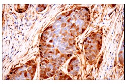 Cell Signaling Technology&nbsp;Transgelin/TAGLN F3B7H Rabbi