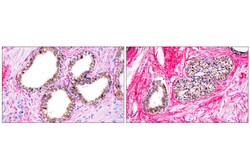 Cell Signaling Technology&nbsp;SignalStainR IHC Dual Staini