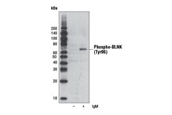 Cell Signaling Technology&nbsp;Phospho-BLNK Tyr96 Antibody
