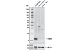 Cell Signaling Technology&nbsp;S100A7 Antibody 100 ul