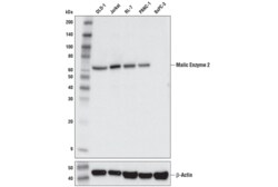 Cell Signaling Technology&nbsp;Malic Enzyme 2 E1N3F XPR R