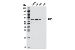 Cell Signaling Technology LCP1 D1C3 Rabbit mAb 100 ul
