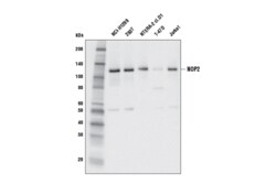 Cell Signaling Technology&nbsp;NOP2 L221 Antibody 100 ul
