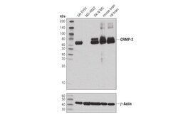 Cell Signaling Technology CRMP-2 D8L6V Rabbit mAb 100